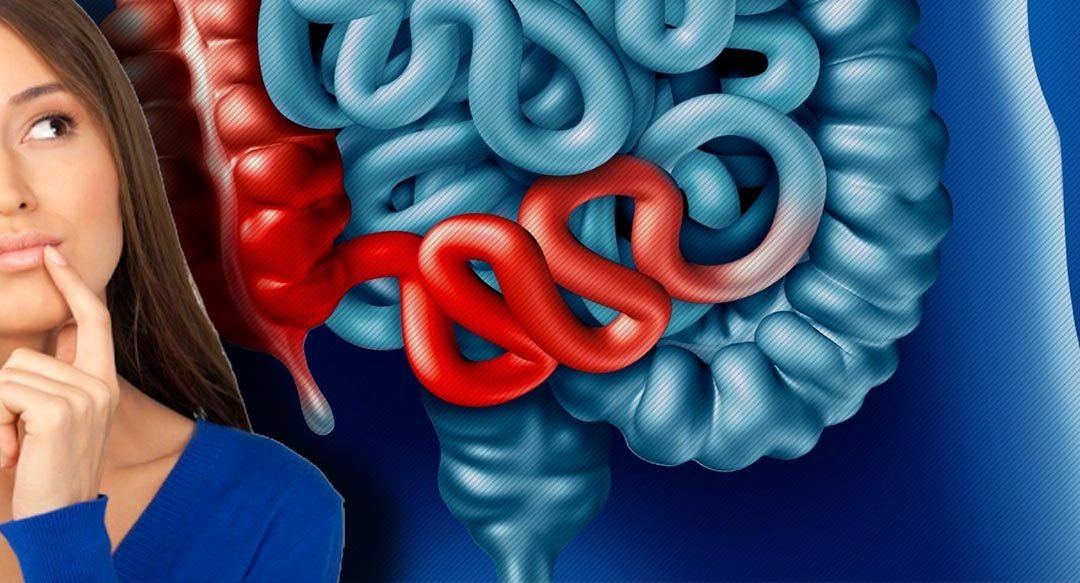 L2IP abre tratamento para doenças inflamatórias intestinais